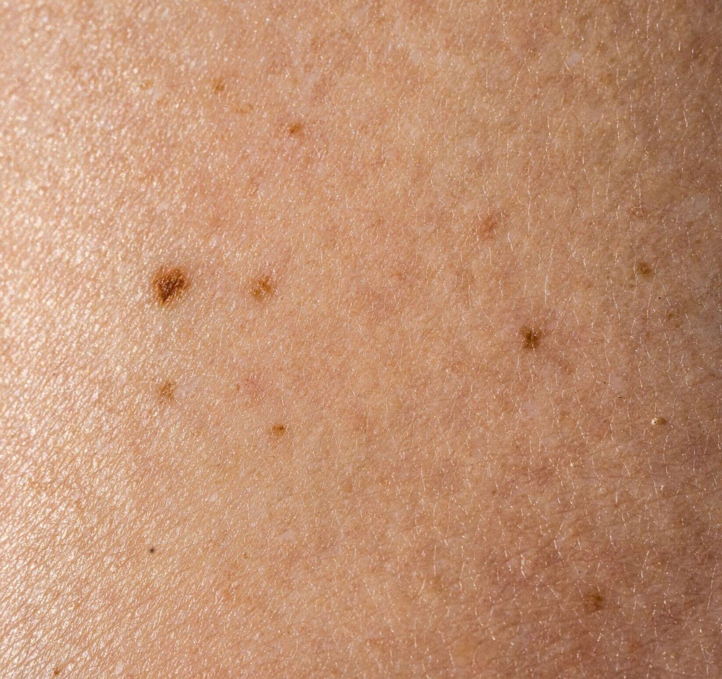 Praxis für Handchirurgie, Plastische und Ästhetische Chirurgie Doctor medic Adrian Cinca, Marktstraße 1 in Bühl