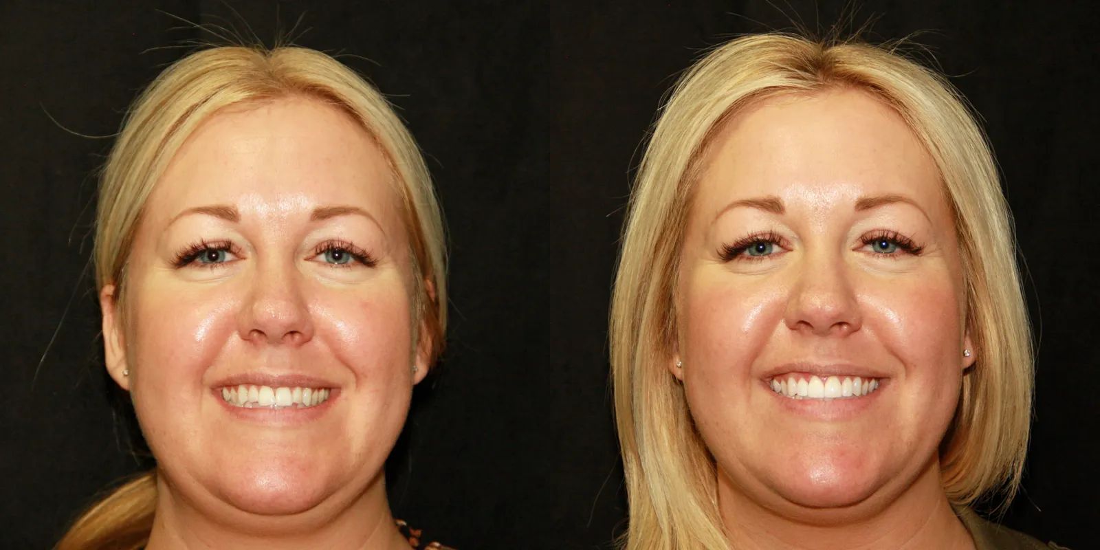 Intermountain Smiles Image