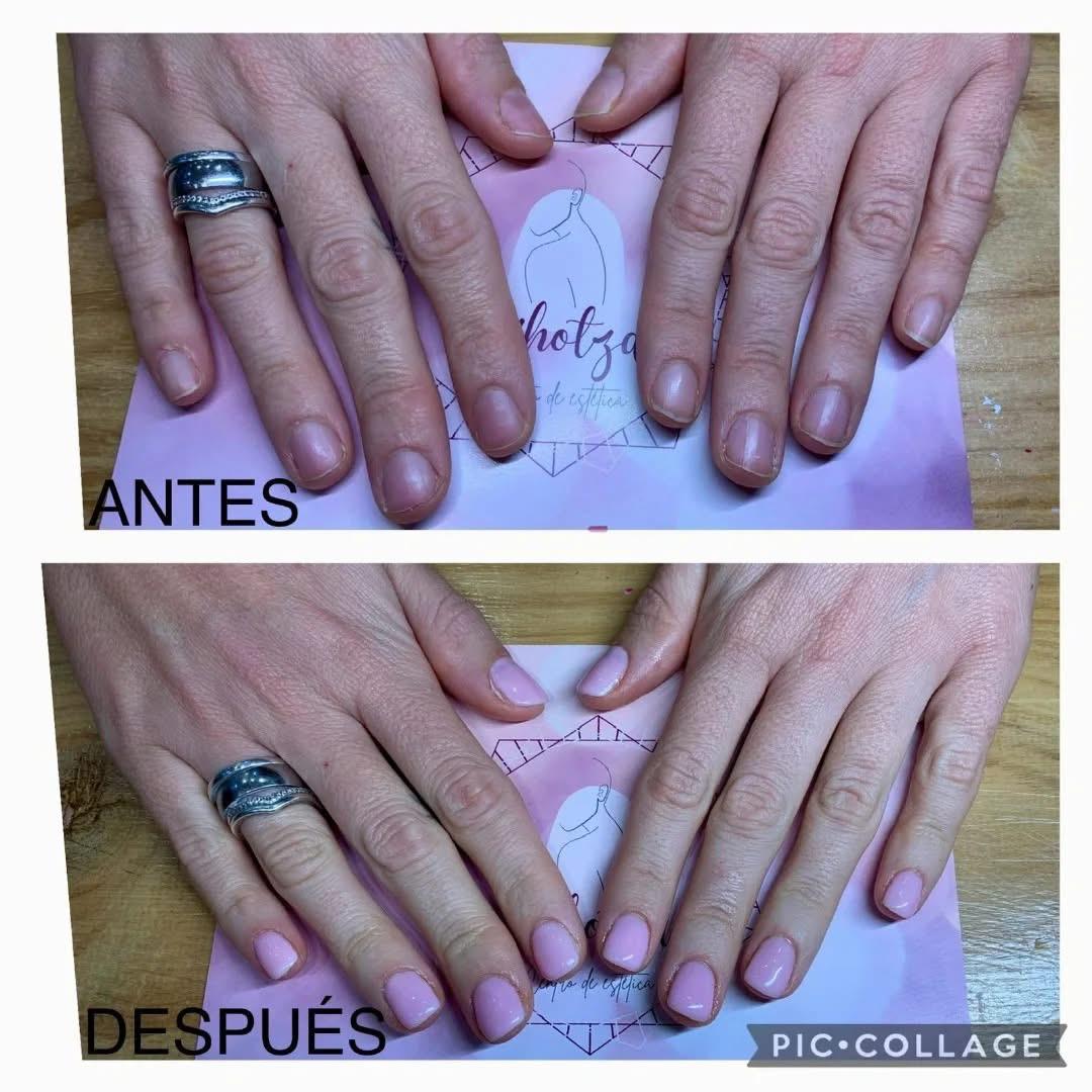 Images Centro de Estética Bihotza