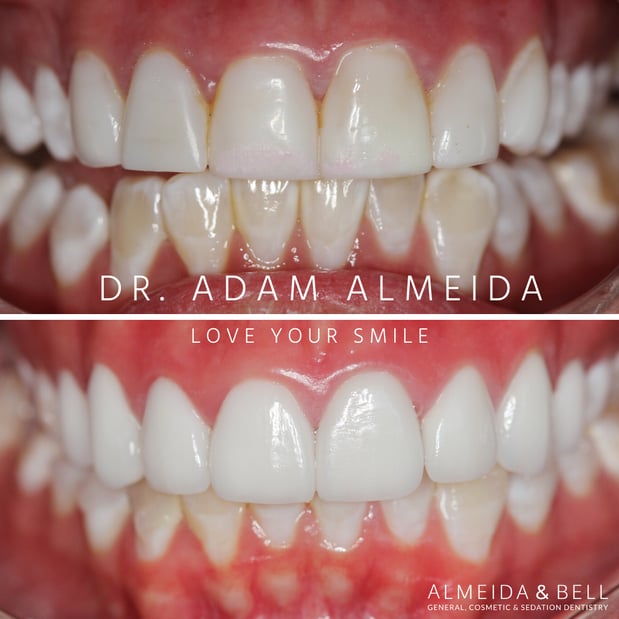 Images Almeida & Bell Dental Lone Tree - General, Cosmetic, and Implant Dentistry