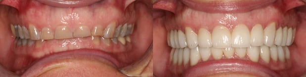 Images Castle Rock Family Dental