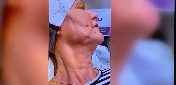 Images Renew Body Contouring & MedSpa