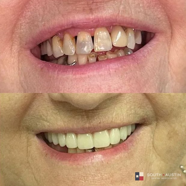 Images South Austin Dental Associates