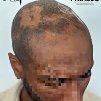 Images The Scalp Master