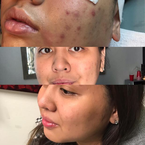 Images RAREV Med Spa