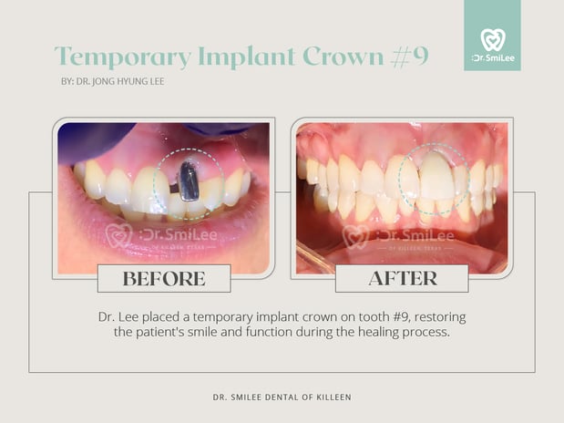 Images Dr Smilee Dental of Killeen, Family, Cosmetic, Implant, Medspa