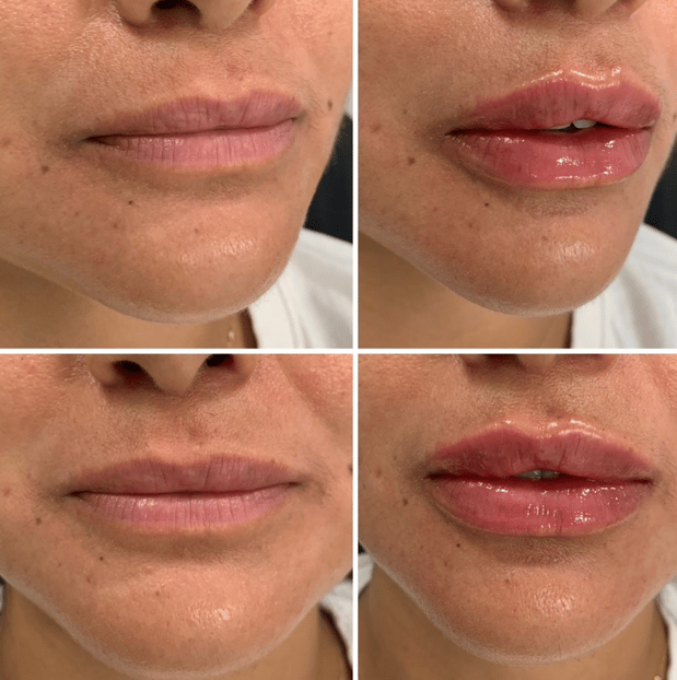 Images Serenity Aesthetics & Wellness