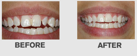 Images Cedar Ridge Esthetic and Family Dentistry