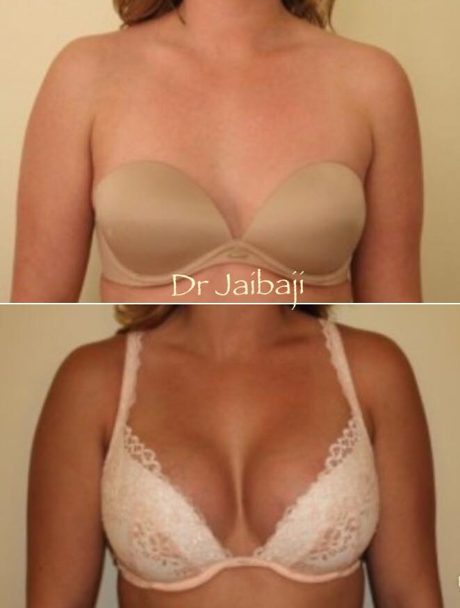 Jaibaji Plastic Surgery Photo