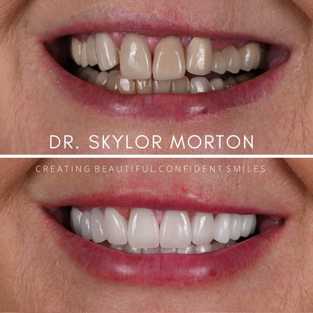 Images Nashville Wisdom Teeth and Implant Solutions