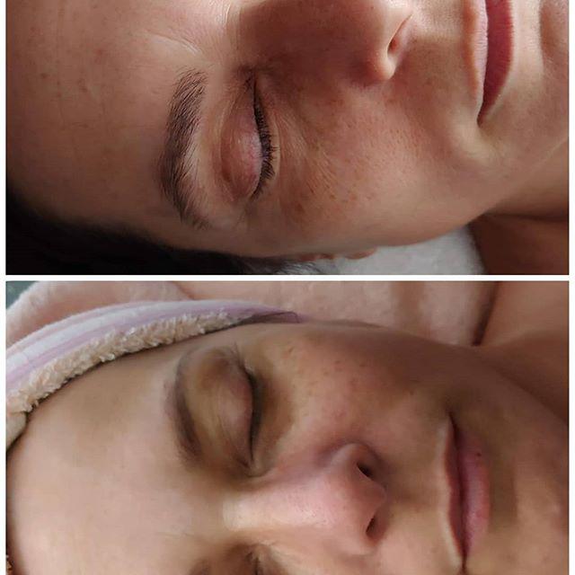 Images All About Face