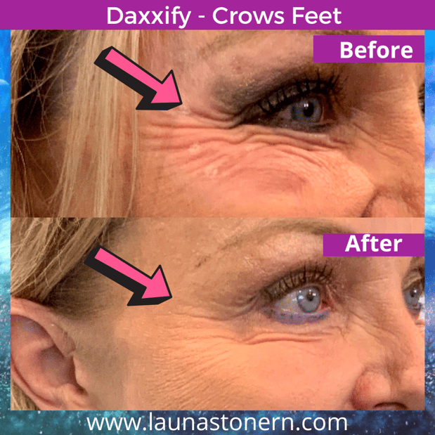 Images Launa Stone, R.N.