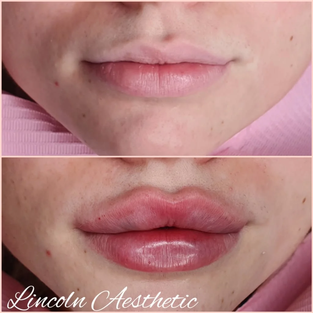 Images Lincoln Aesthetic