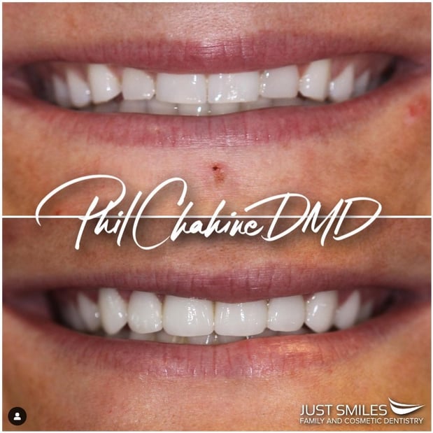 Images Just Smiles - General, Cosmetic & Implant Dentistry