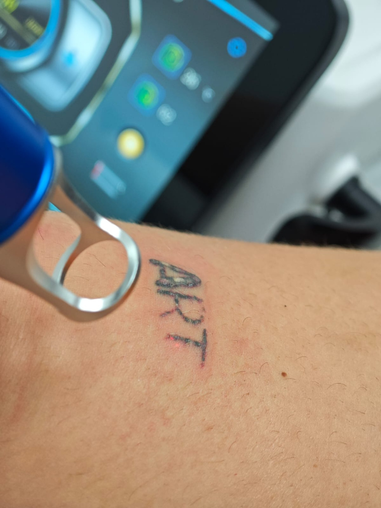 Images Dra. Silvia Solà. Medicina Estética y Láser