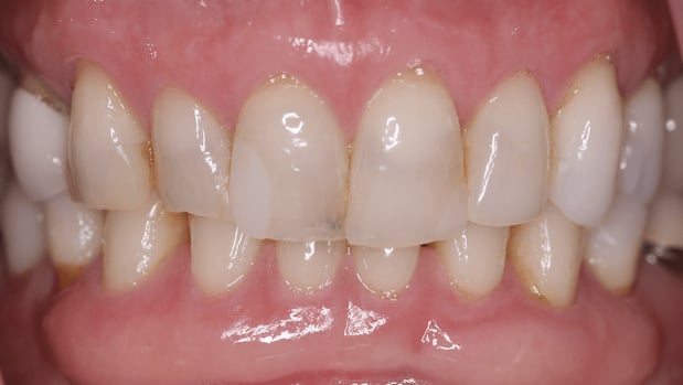 Images SmileCare Dental