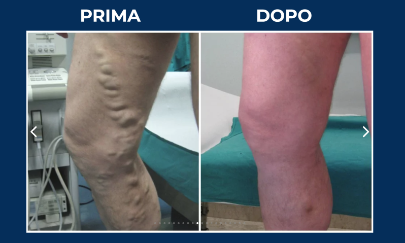 Images Dott. Massimo Gallucci | Specialista in Angiologia