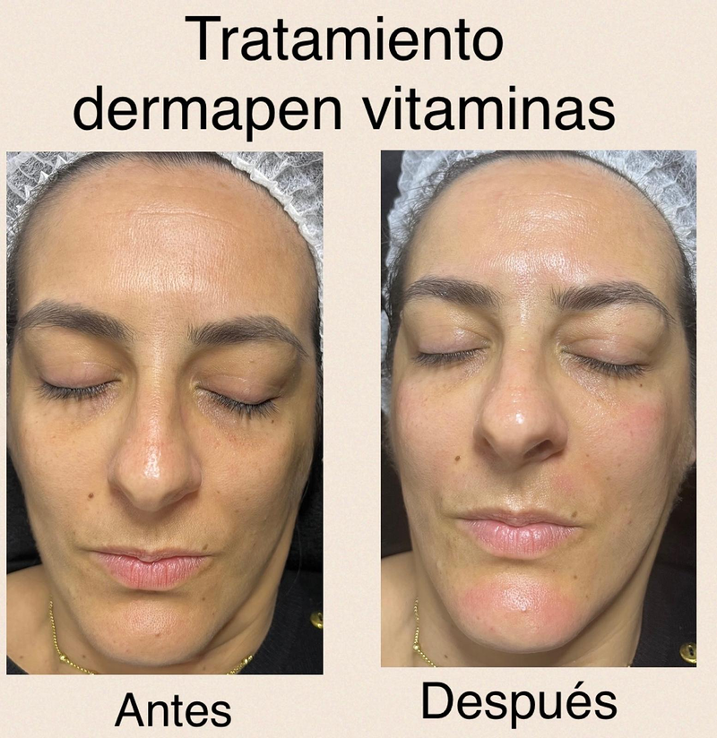 Images Centro De Estética Avanzada Y Láser Verónica Vico