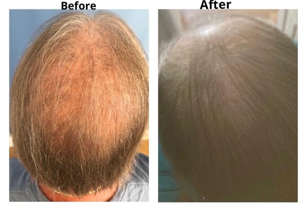 Images Dr. George Brennan - Cosmetic Surgeon Newport Beach