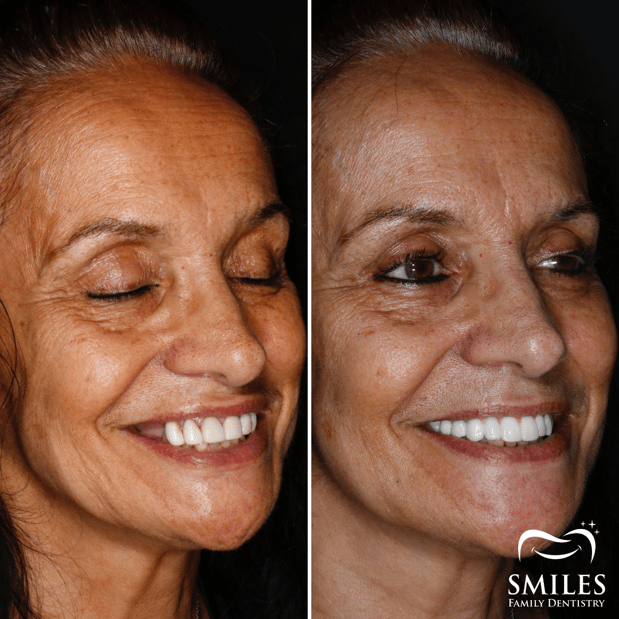 Images Brunswick Smiles Family Dentistry Implant, Oral Surgery, and Cosmetic Dentist