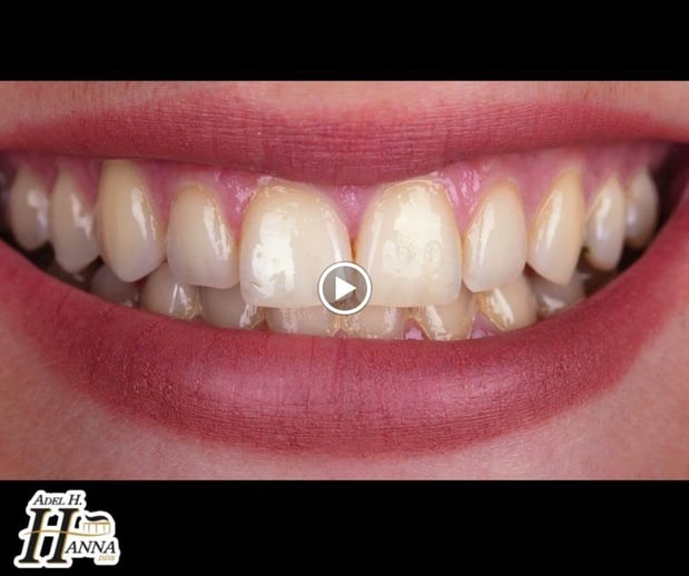 Images Adel H Hanna, DDS & Assoc.