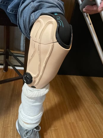 Images EastPoint Prosthetics and Orthotics