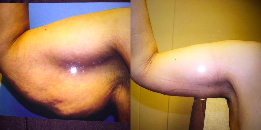 Before & After from Steven H. Wiener, MD: New Image Plastic Surgery | Scottsdale, AZ