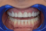 Image 7 | Advanced Family Dentistry