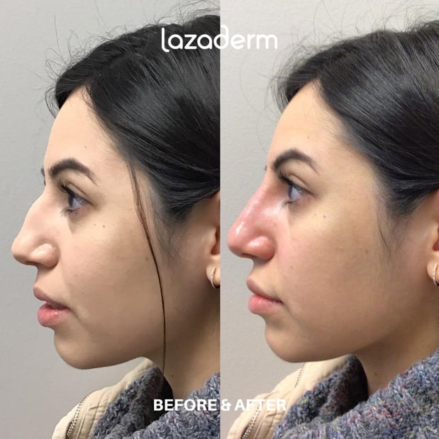 Images Lazaderm