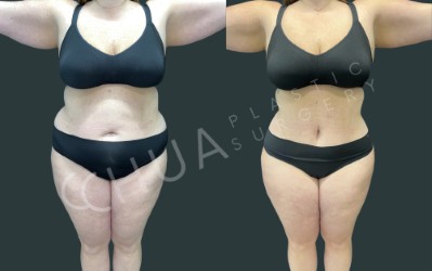 Images Chua Plastic Surgery