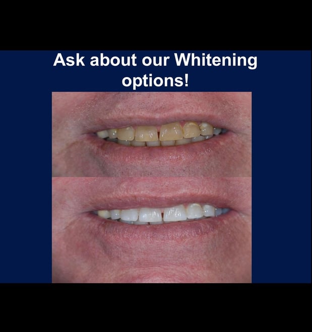 Images Decatur Smiles