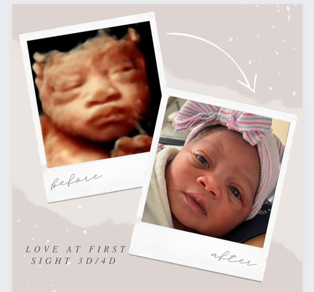 Images Love At First Sight 3D/4D Ultrasound Imaging Studio, LLC
