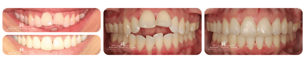 Images Aspire Dental Care PLLC