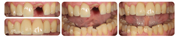 Images Aspire Dental Care PLLC