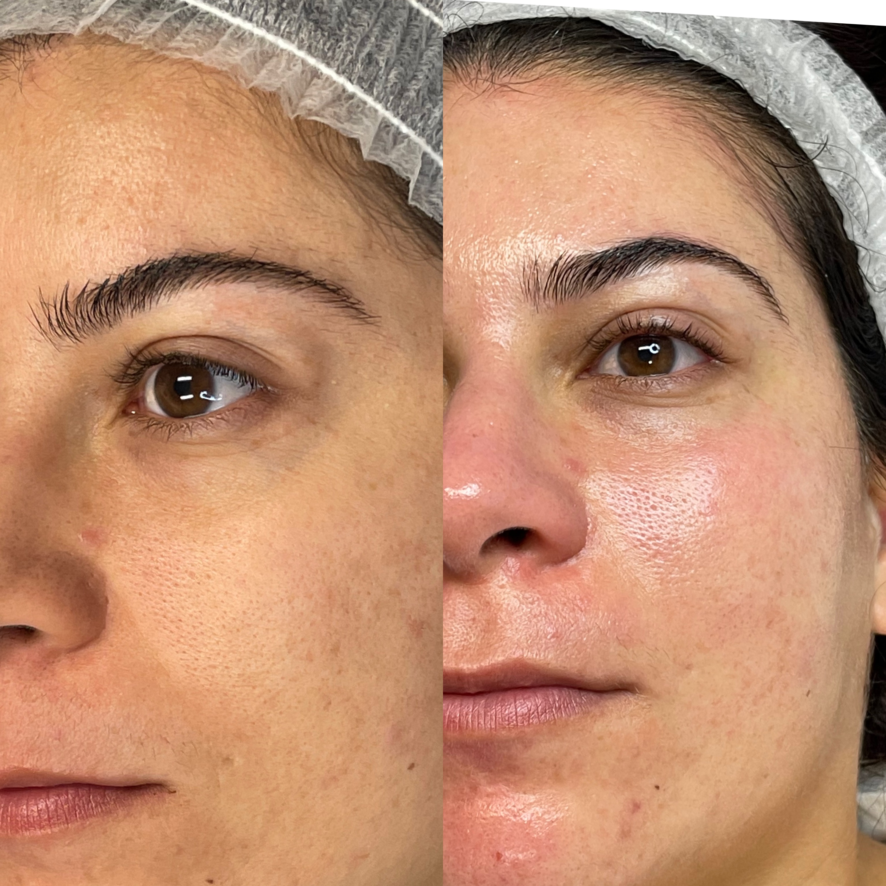 Images Clinique d'Esthétique Leila - Hydrafacial, Microblading, Épilation Laser Sainte-Foy