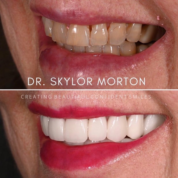 Images Nashville Wisdom Teeth and Implant Solutions