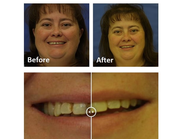 Images David A. Rice, DDS