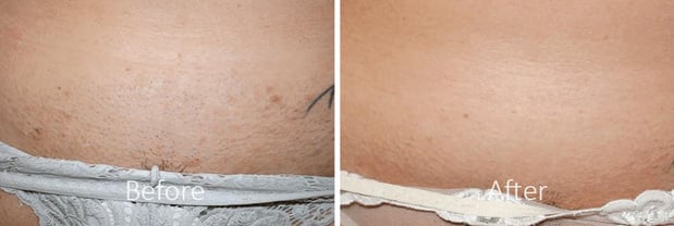 Images Cratos Health Calculated - Southgate