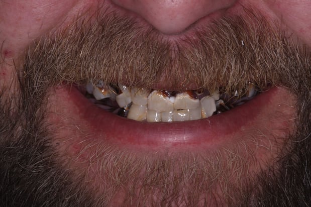 Images SmileCare Dental