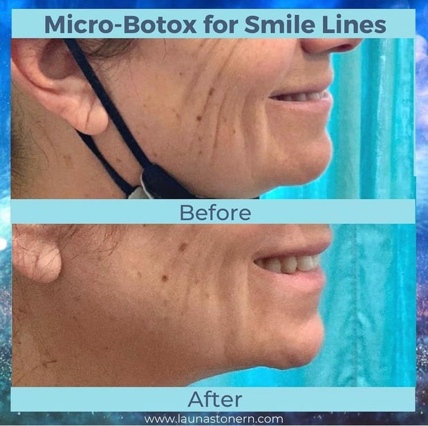 Images Launa Stone, R.N.