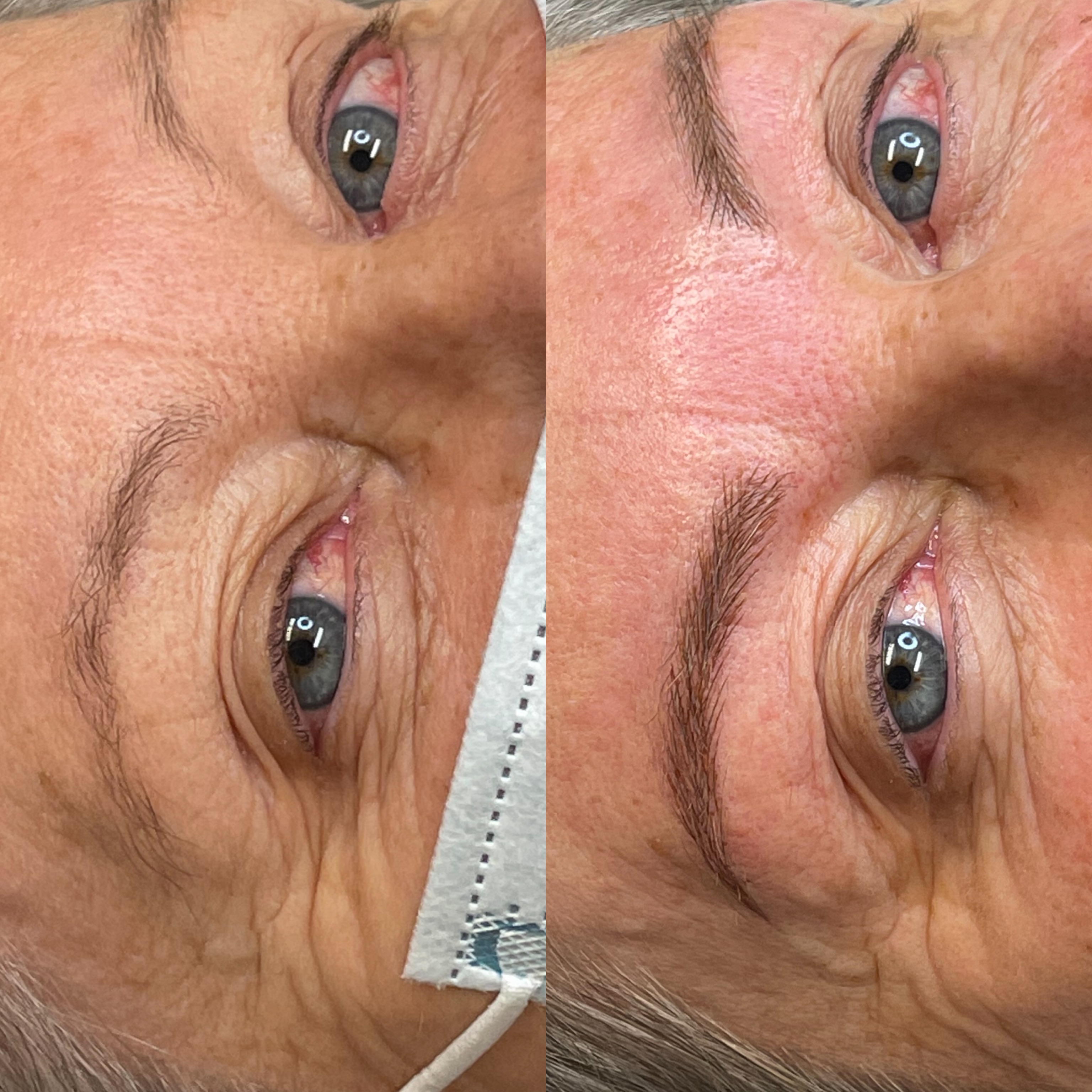Images Clinique d'Esthétique Leila - Hydrafacial, Microblading, Épilation Laser Sainte-Foy