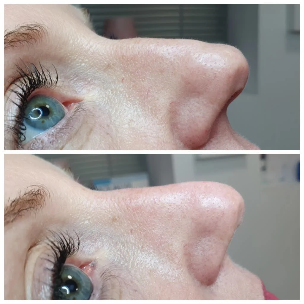 Images Lincoln Aesthetic