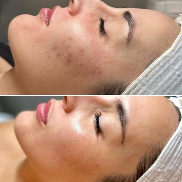 Images Injections and Co.