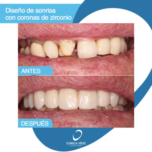 Images Clínica Dental y Estética Vélez