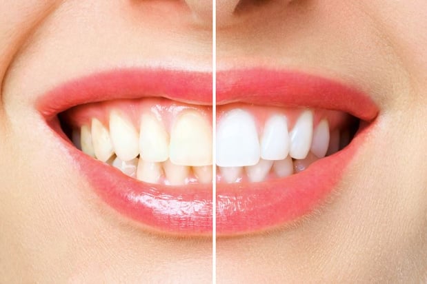 Images Reuter Family Dentistry
