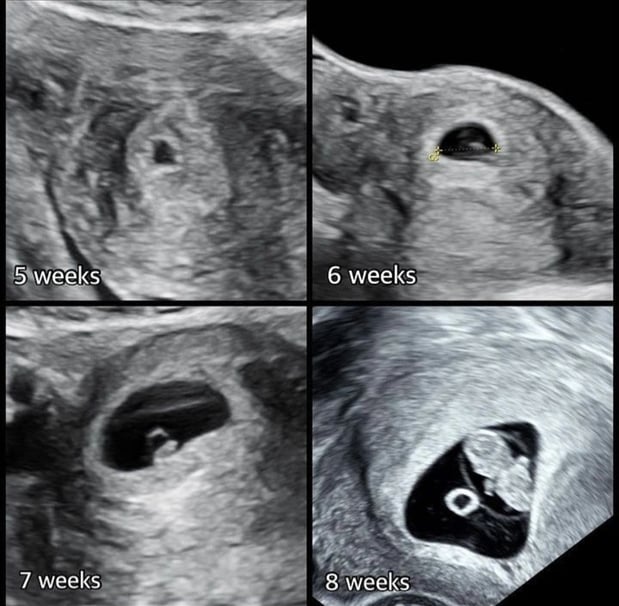Images Love At First Sight 3D/4D Ultrasound Imaging Studio, LLC