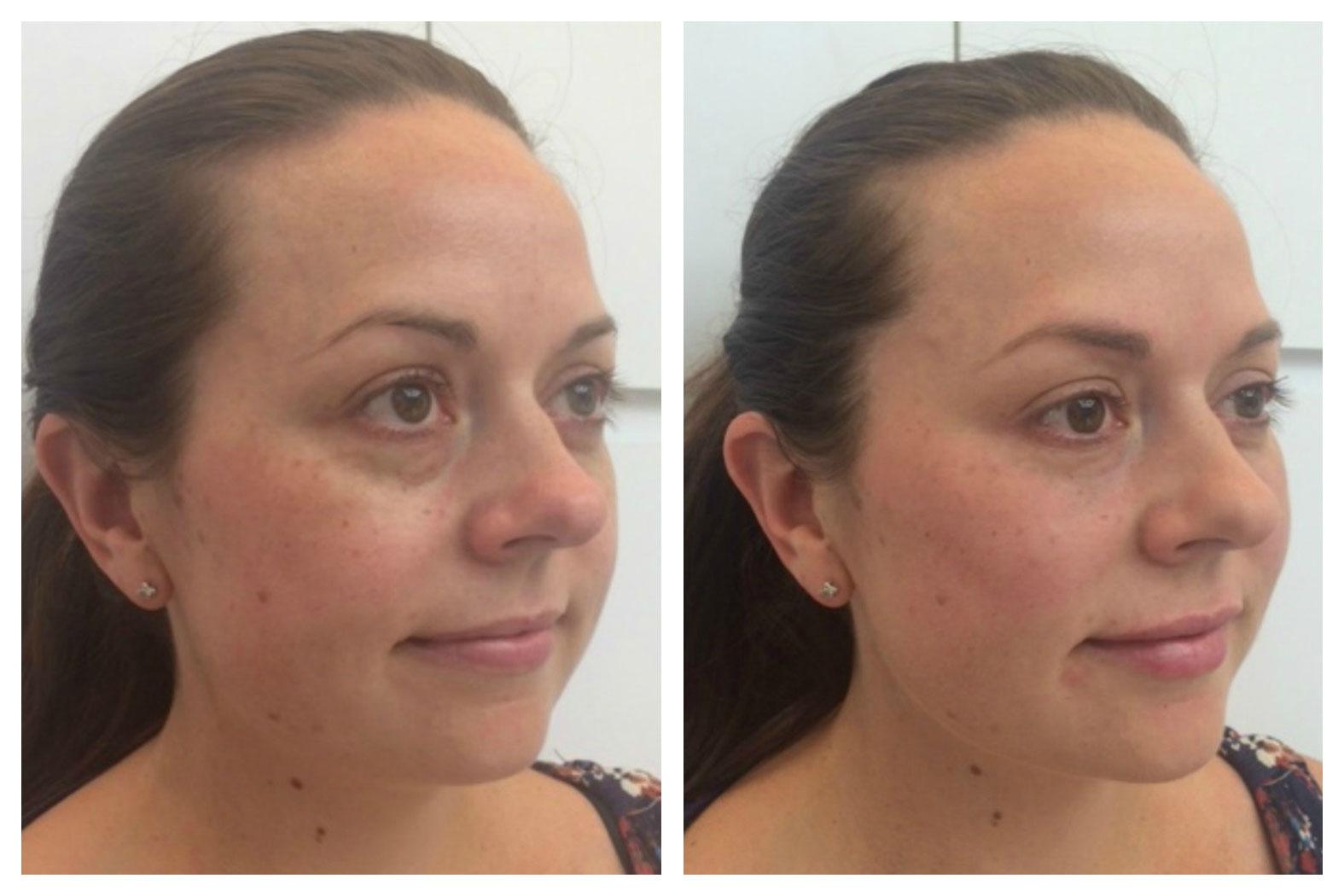 Images About Face Medical Aesthetics - Richmond