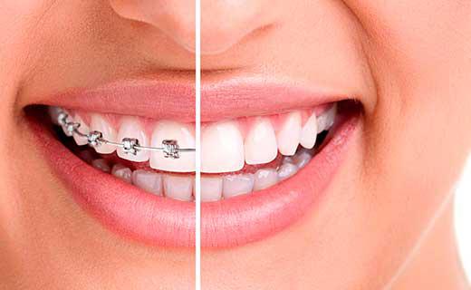 Images Perfect Smile Dental Care
