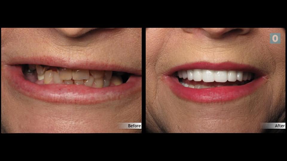 Orlando Lifestyle Dentistry Image