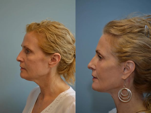 Images Providence Facial Plastic and Cosmetic Surgery